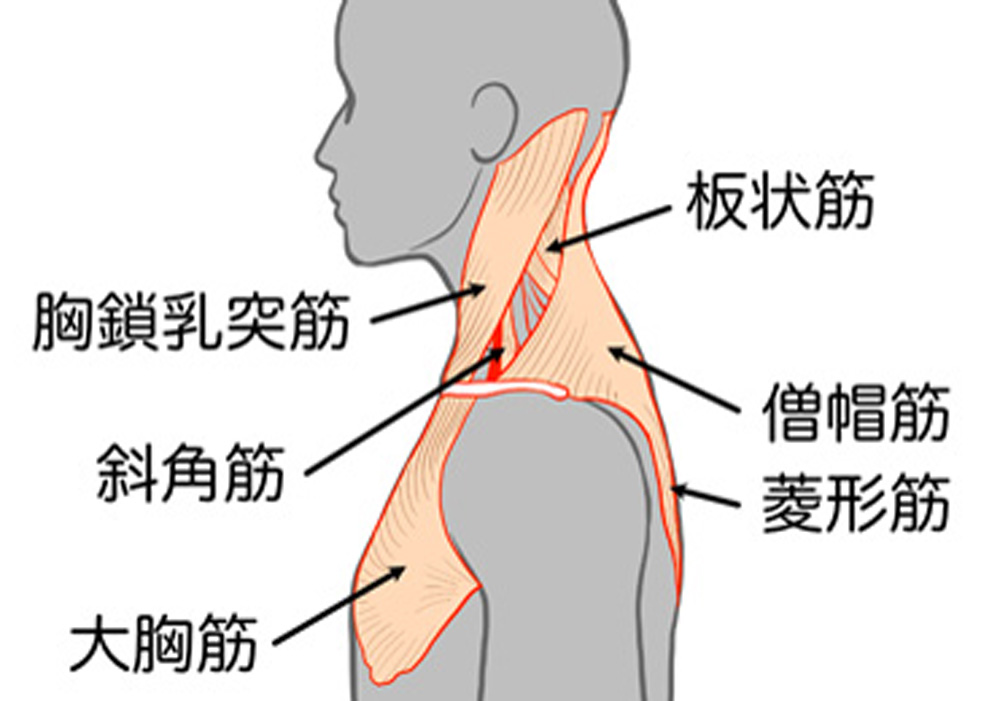 頚椎捻挫